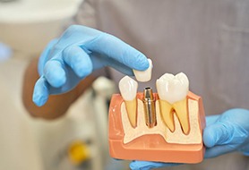 dentist placing a crown on a model of a dental implant