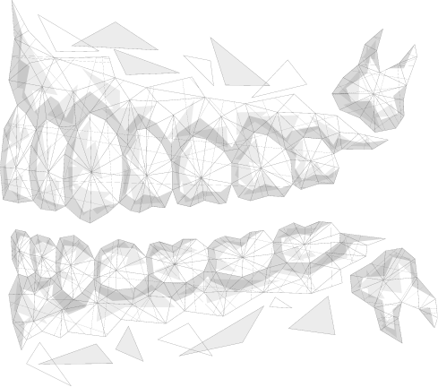 Animated model of impacted wisdom teeth