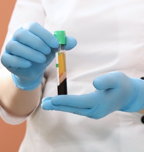 Oral surgeon holding up platelet rich plasma treatment vial