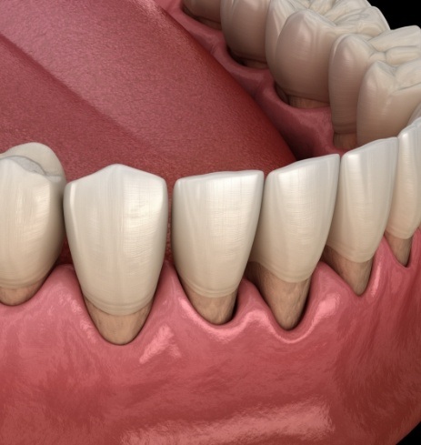 Animated damaged smile before oral pathology