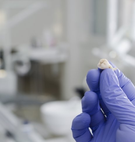 Oral surgeon holding an extracted tooth